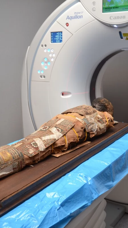 Ciekawostka z Lublina. Mumia dziecka pod lupą lubelskich radiologów